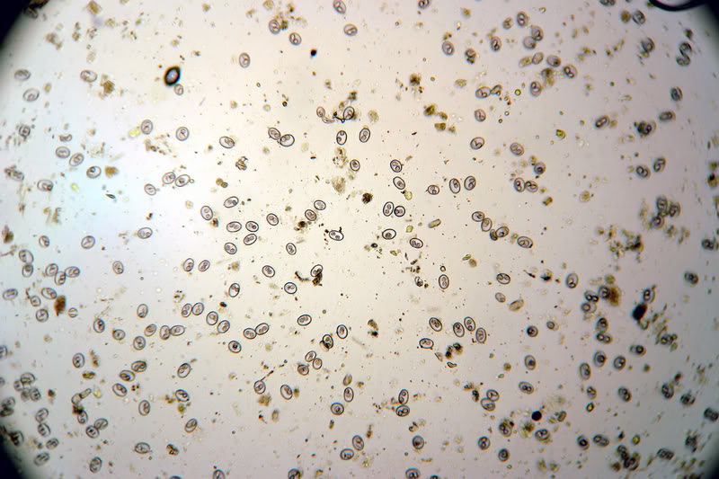 Споры в кале у взрослого. Кокцидиоз кур микроскопия. Нозематоз пчел микроскопия. Яйца кокцидий микроскоп. Кокцидии микробиология.